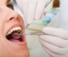 Dấu hiệu nhận biết viêm nướu quanh răng