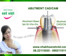 Abutment CAD/CAM
