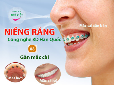 Nieng-rang-cong-nghe-3d-han-quoc-03