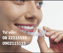 Mô hình niềng răng eCligner 3D