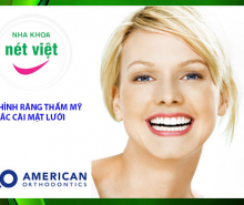 Chỉnh răng thẩm mỹ mặt lưỡi – American Orthodontics